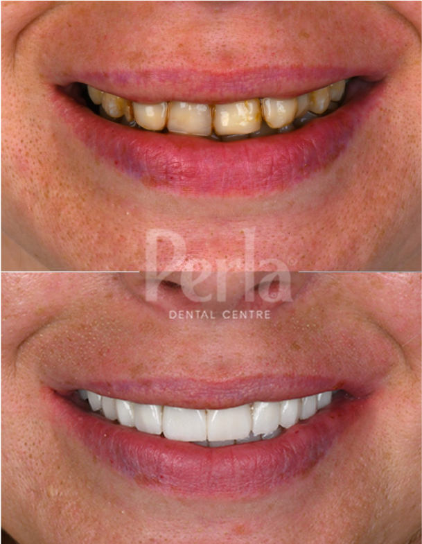 dental and oral hygiene